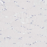 EBP50 Antibody in Immunohistochemistry (Paraffin) (IHC (P))