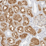 EBP50 Antibody in Immunohistochemistry (Paraffin) (IHC (P))