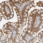 EBP50 Antibody in Immunohistochemistry (Paraffin) (IHC (P))