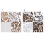 EBP50 Antibody in Immunohistochemistry (Paraffin) (IHC (P))