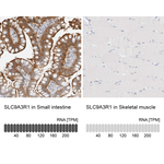 EBP50 Antibody in Immunohistochemistry (Paraffin) (IHC (P))