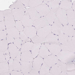 Calbindin D28K Antibody in Immunohistochemistry (Paraffin) (IHC (P))
