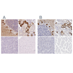 Calbindin D28K Antibody in Immunohistochemistry (Paraffin) (IHC (P))