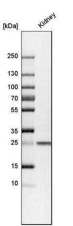 Calbindin D28K Antibody in Western Blot (WB)