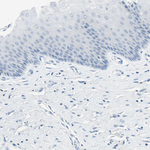 GDF15 Antibody in Immunohistochemistry (Paraffin) (IHC (P))