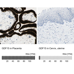 GDF15 Antibody in Immunohistochemistry (Paraffin) (IHC (P))