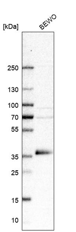 GDF15 Antibody in Western Blot (WB)