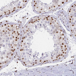 CBP Antibody in Immunohistochemistry (Paraffin) (IHC (P))