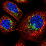 VAMP4 Polyclonal Antibody