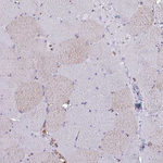 VAMP4 Antibody in Immunohistochemistry (Paraffin) (IHC (P))