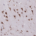 VAMP4 Antibody in Immunohistochemistry (Paraffin) (IHC (P))