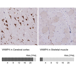 VAMP4 Antibody in Immunohistochemistry (Paraffin) (IHC (P))
