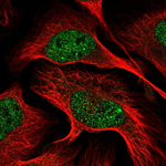 Dynamin 1 Polyclonal Antibody