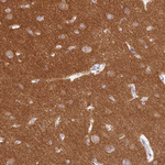 Dynamin 1 Antibody in Immunohistochemistry (Paraffin) (IHC (P))