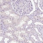 Dynamin 1 Antibody in Immunohistochemistry (Paraffin) (IHC (P))