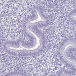 OLIG2 Antibody in Immunohistochemistry (Paraffin) (IHC (P))