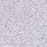 OLIG2 Antibody in Immunohistochemistry (Paraffin) (IHC (P))