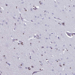 OLIG2 Antibody in Immunohistochemistry (Paraffin) (IHC (P))