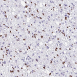 OLIG2 Antibody in Immunohistochemistry (Paraffin) (IHC (P))
