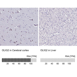 OLIG2 Polyclonal Antibody