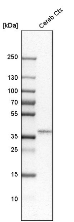 OLIG2 Antibody in Western Blot (WB)
