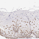 Estrogen Receptor alpha Antibody in Immunohistochemistry (Paraffin) (IHC (P))