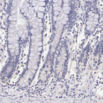 Estrogen Receptor alpha Antibody in Immunohistochemistry (Paraffin) (IHC (P))