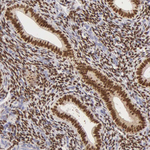 Estrogen Receptor alpha Antibody in Immunohistochemistry (Paraffin) (IHC (P))