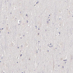 Estrogen Receptor alpha Antibody in Immunohistochemistry (Paraffin) (IHC (P))