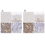 Estrogen Receptor alpha Polyclonal Antibody