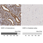 Estrogen Receptor alpha Antibody in Immunohistochemistry (Paraffin) (IHC (P))
