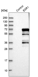 Estrogen Receptor alpha Antibody in Western Blot (WB)