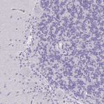 FOXO4 Antibody in Immunohistochemistry (Paraffin) (IHC (P))