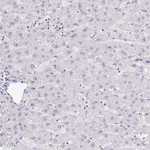 FOXO4 Antibody in Immunohistochemistry (Paraffin) (IHC (P))