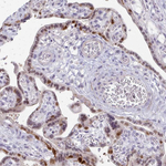 FOXO4 Antibody in Immunohistochemistry (Paraffin) (IHC (P))