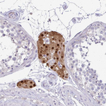 FOXO4 Antibody in Immunohistochemistry (Paraffin) (IHC (P))