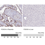 FOXO4 Antibody in Immunohistochemistry (Paraffin) (IHC (P))