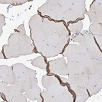 PDIA6 Antibody in Immunohistochemistry (Paraffin) (IHC (P))
