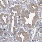 PDIA6 Antibody in Immunohistochemistry (Paraffin) (IHC (P))