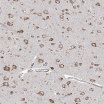 PDIA6 Antibody in Immunohistochemistry (Paraffin) (IHC (P))