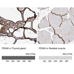 PDIA6 Antibody in Immunohistochemistry (Paraffin) (IHC (P))