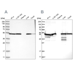 PDIA6 Antibody in Western Blot (WB)