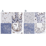 GM130 Polyclonal Antibody