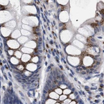 GM130 Antibody in Immunohistochemistry (Paraffin) (IHC (P))