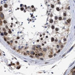 GM130 Antibody in Immunohistochemistry (Paraffin) (IHC (P))