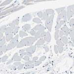 EBP50 Antibody in Immunohistochemistry (Paraffin) (IHC (P))