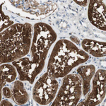 EBP50 Antibody in Immunohistochemistry (Paraffin) (IHC (P))