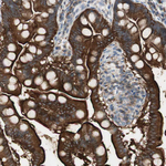 EBP50 Antibody in Immunohistochemistry (Paraffin) (IHC (P))