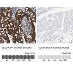 EBP50 Antibody in Immunohistochemistry (Paraffin) (IHC (P))