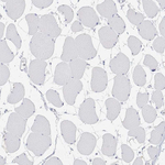 Calbindin D28K Antibody in Immunohistochemistry (Paraffin) (IHC (P))